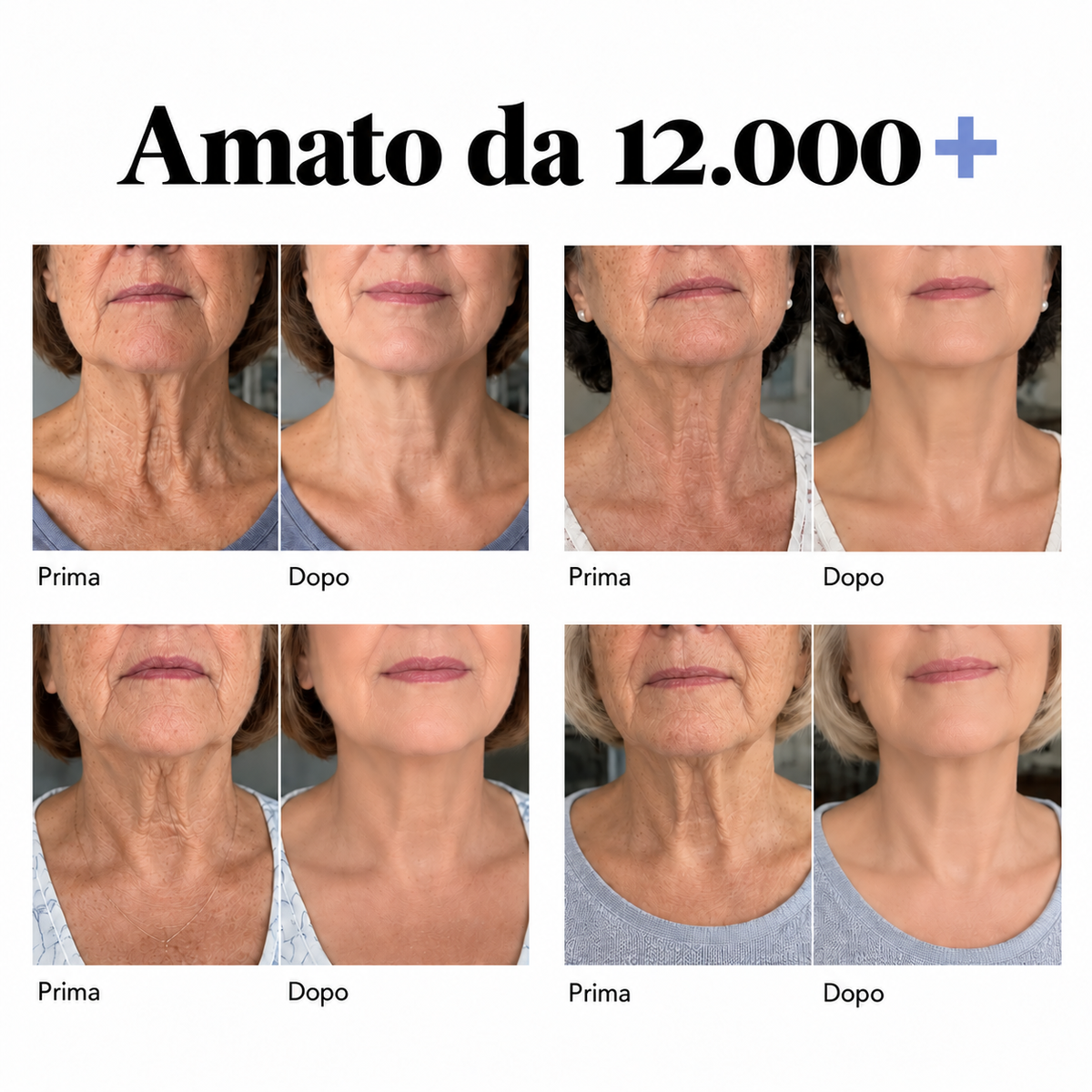 Mirabellaroma™ Lift – Torna ad amare il tuo collo