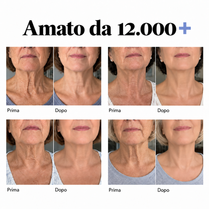 Mirabellaroma™ Lift – Torna ad amare il tuo collo