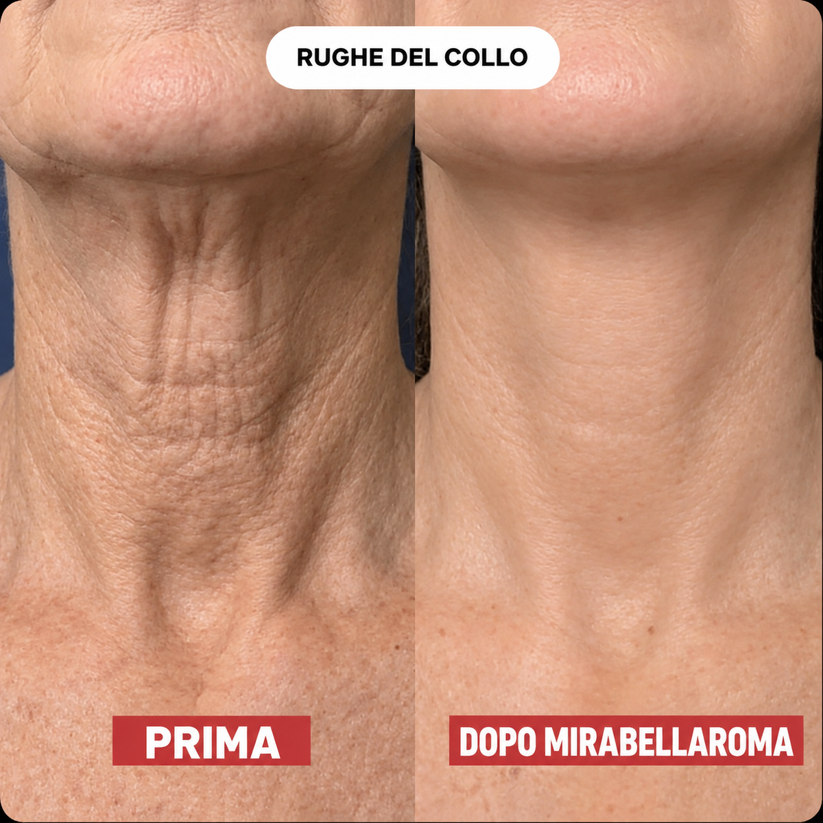 Mirabellaroma™ Lift – Torna ad amare il tuo collo